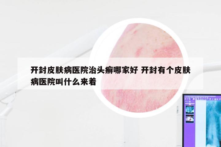 开封皮肤病医院治头癣哪家好 开封有个皮肤病医院叫什么来着