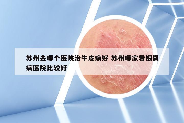 苏州去哪个医院治牛皮癣好 苏州哪家看银屑病医院比较好