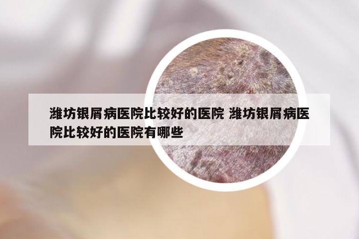 潍坊银屑病医院比较好的医院 潍坊银屑病医院比较好的医院有哪些