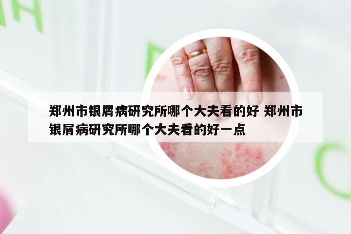郑州市银屑病研究所哪个大夫看的好 郑州市银屑病研究所哪个大夫看的好一点