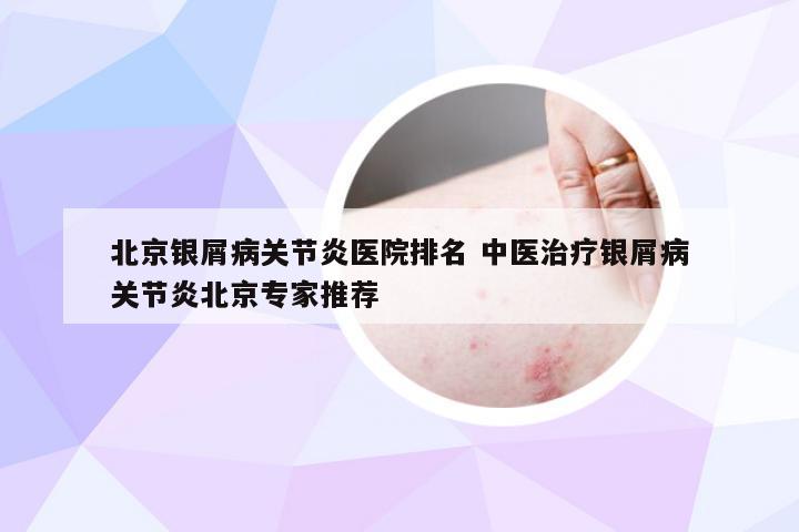北京银屑病关节炎医院排名 中医治疗银屑病关节炎北京专家推荐