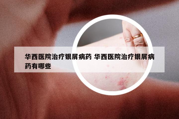 华西医院治疗银屑病药 华西医院治疗银屑病药有哪些