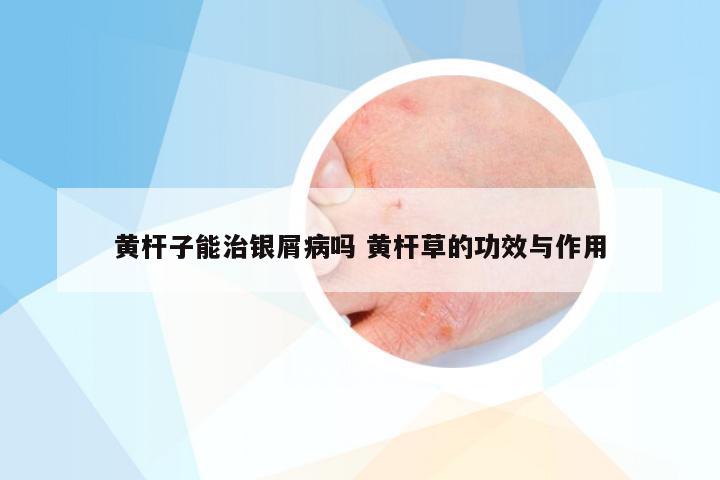 黄杆子能治银屑病吗 黄杆草的功效与作用