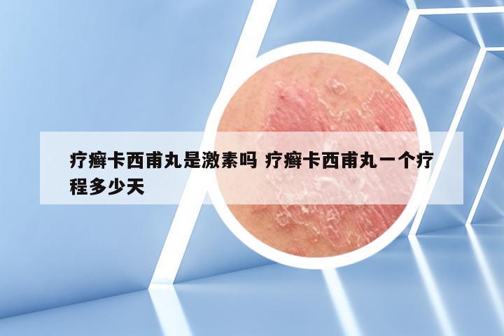 疗癣卡西甫丸是激素吗 疗癣卡西甫丸一个疗程多少天