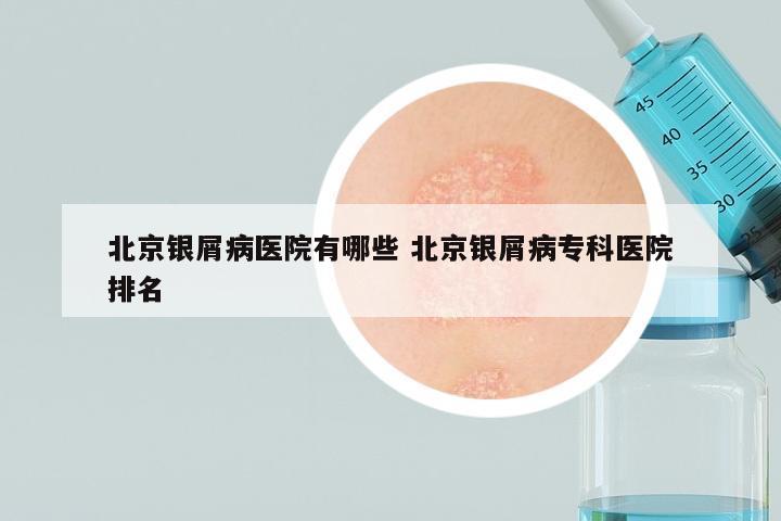 北京银屑病医院有哪些 北京银屑病专科医院排名