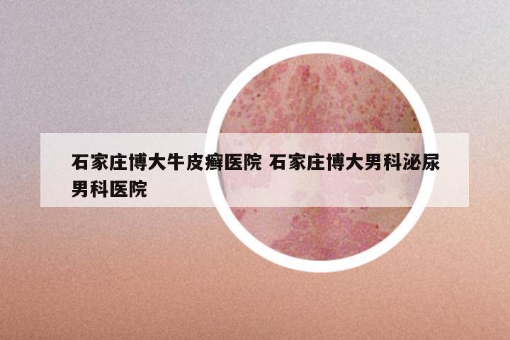 石家庄博大牛皮癣医院 石家庄博大男科泌尿男科医院