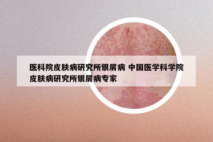 医科院皮肤病研究所银屑病 中国医学科学院皮肤病研究所银屑病专家