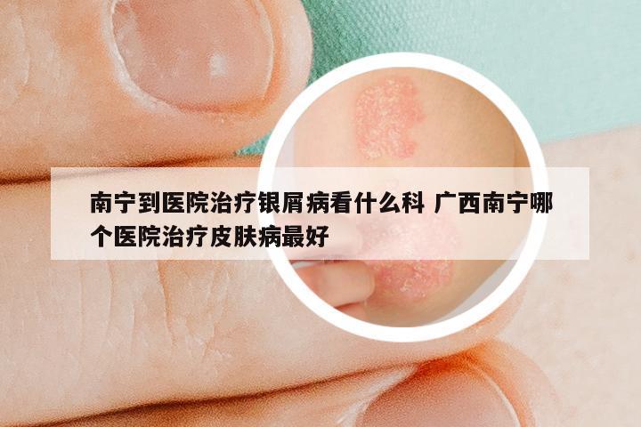 南宁到医院治疗银屑病看什么科 广西南宁哪个医院治疗皮肤病最好