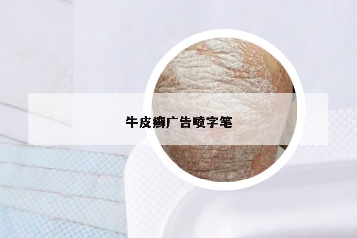 牛皮癣广告喷字笔