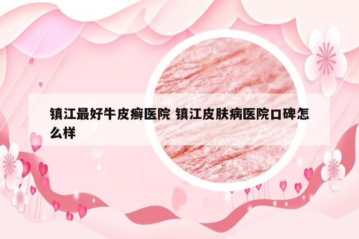 镇江最好牛皮癣医院 镇江皮肤病医院口碑怎么样