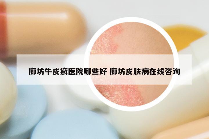 廊坊牛皮癣医院哪些好 廊坊皮肤病在线咨询