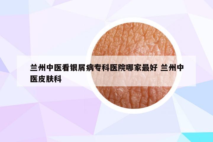 兰州中医看银屑病专科医院哪家最好 兰州中医皮肤科