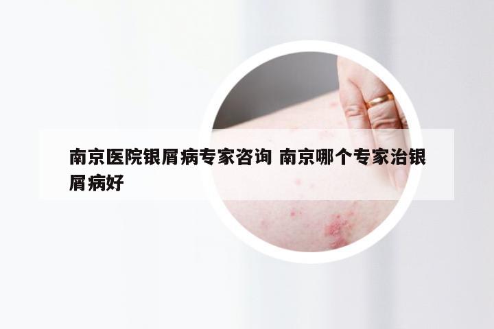 南京医院银屑病专家咨询 南京哪个专家治银屑病好