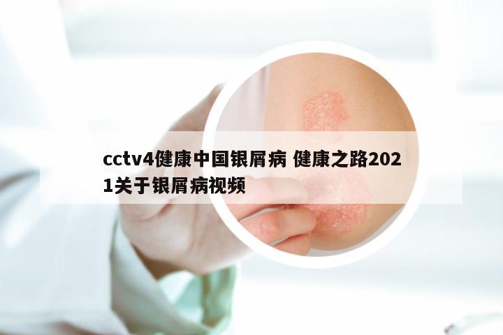 cctv4健康中国银屑病 健康之路2021关于银屑病视频