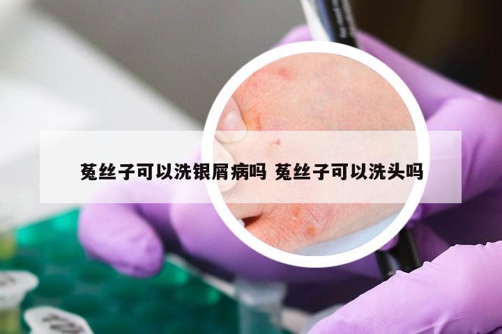 菟丝子可以洗银屑病吗 菟丝子可以洗头吗