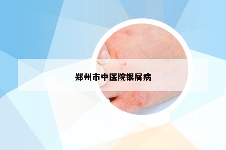 郑州市中医院银屑病