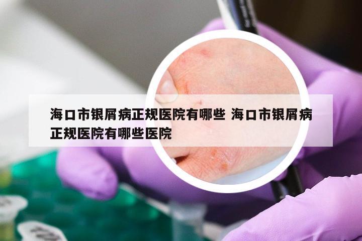 海口市银屑病正规医院有哪些 海口市银屑病正规医院有哪些医院