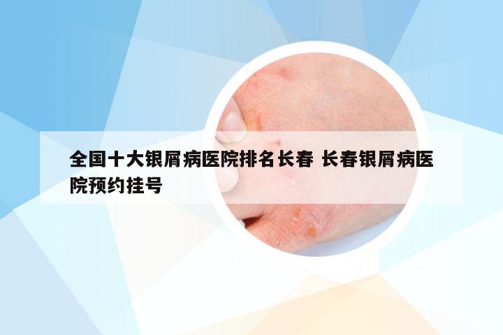 全国十大银屑病医院排名长春 长春银屑病医院预约挂号