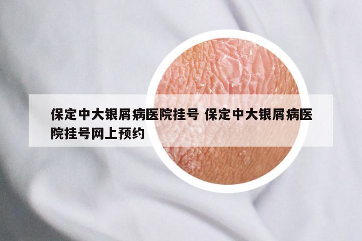 保定中大银屑病医院挂号 保定中大银屑病医院挂号网上预约