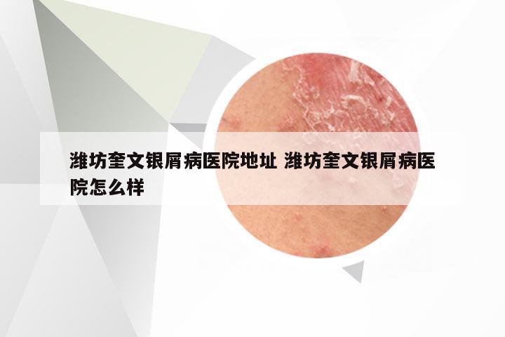 潍坊奎文银屑病医院地址 潍坊奎文银屑病医院怎么样