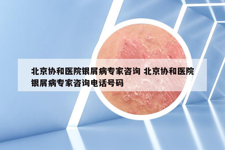 北京协和医院银屑病专家咨询 北京协和医院银屑病专家咨询电话号码
