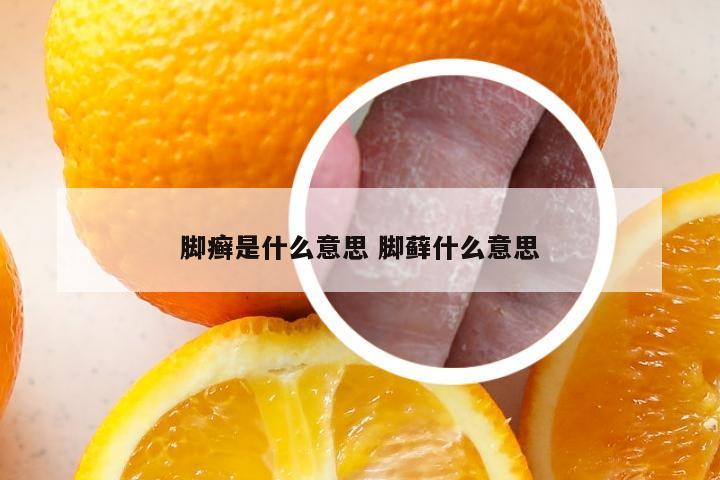 脚癣是什么意思 脚藓什么意思