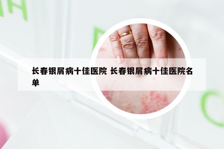 长春银屑病十佳医院 长春银屑病十佳医院名单