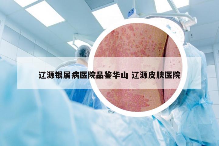 辽源银屑病医院品鉴华山 辽源皮肤医院