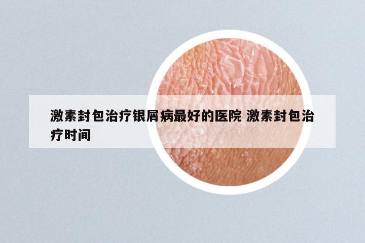 激素封包治疗银屑病最好的医院 激素封包治疗时间