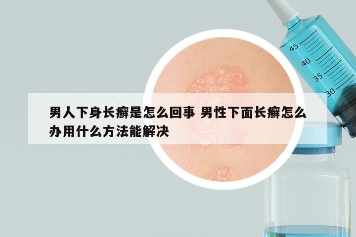 男人下身长癣是怎么回事 男性下面长癣怎么办用什么方法能解决