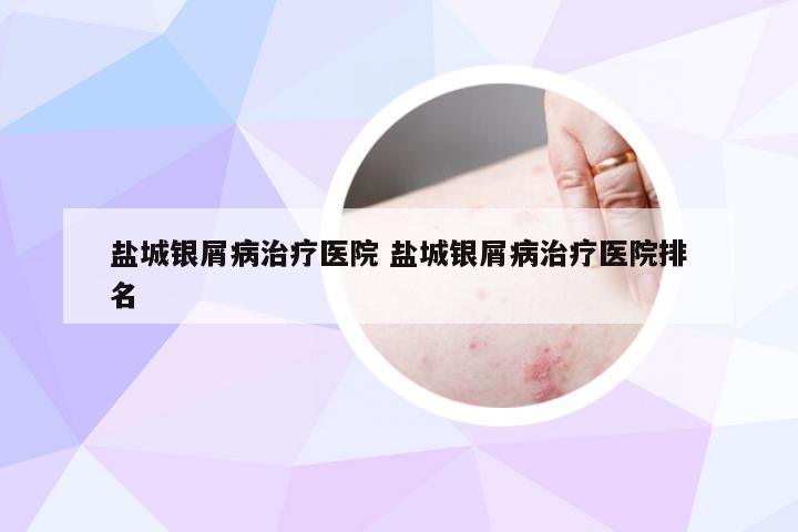 盐城银屑病治疗医院 盐城银屑病治疗医院排名