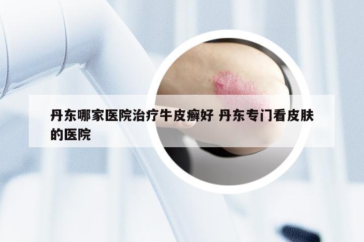 丹东哪家医院治疗牛皮癣好 丹东专门看皮肤的医院
