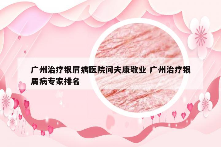 广州治疗银屑病医院问夫康敬业 广州治疗银屑病专家排名