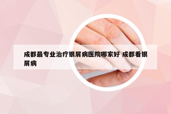 成都最专业治疗银屑病医院哪家好 成都看银屑病