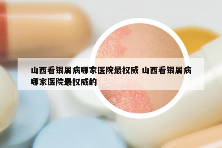 山西看银屑病哪家医院最权威 山西看银屑病哪家医院最权威的