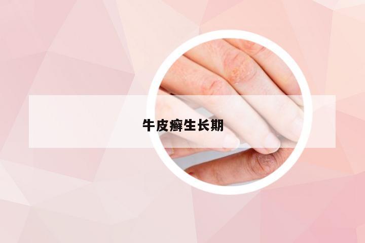 牛皮癣生长期