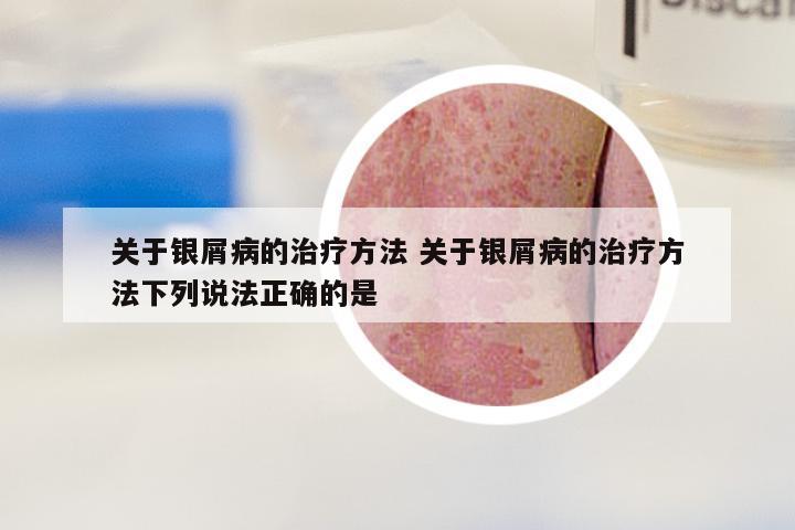 关于银屑病的治疗方法 关于银屑病的治疗方法下列说法正确的是
