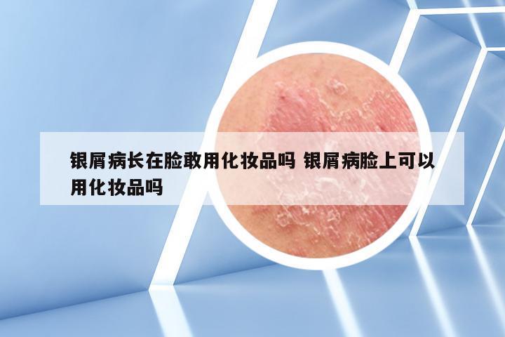 银屑病长在脸敢用化妆品吗 银屑病脸上可以用化妆品吗