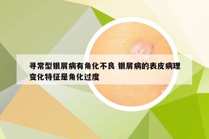 寻常型银屑病有角化不良 银屑病的表皮病理变化特征是角化过度