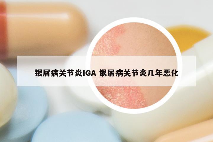 银屑病关节炎IGA 银屑病关节炎几年恶化
