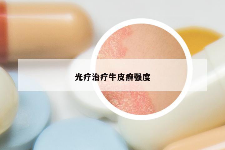 光疗治疗牛皮癣强度
