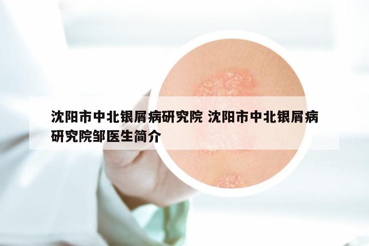 沈阳市中北银屑病研究院 沈阳市中北银屑病研究院邹医生简介
