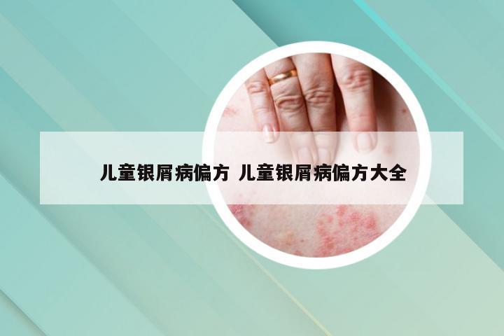 儿童银屑病偏方 儿童银屑病偏方大全