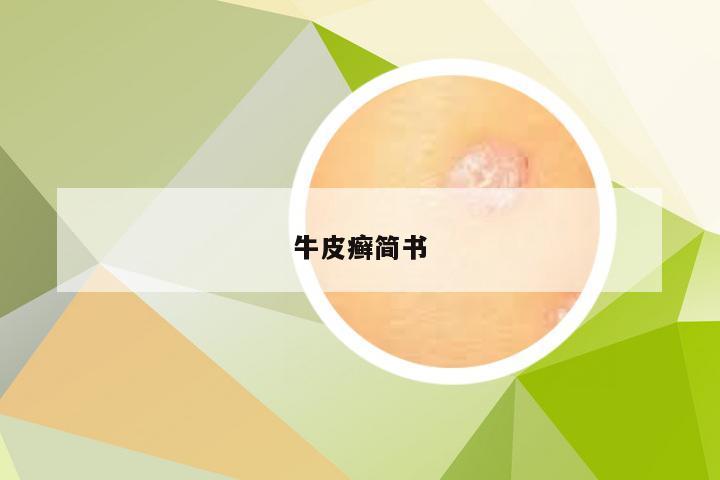 牛皮癣简书