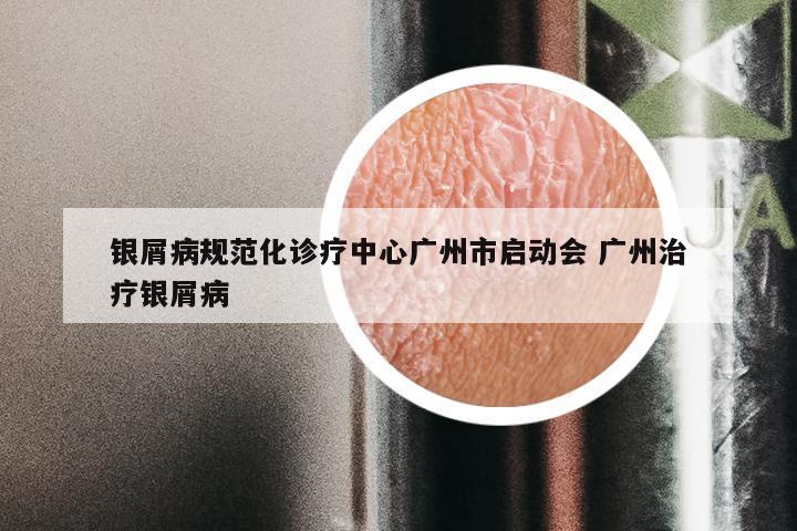 银屑病规范化诊疗中心广州市启动会 广州治疗银屑病