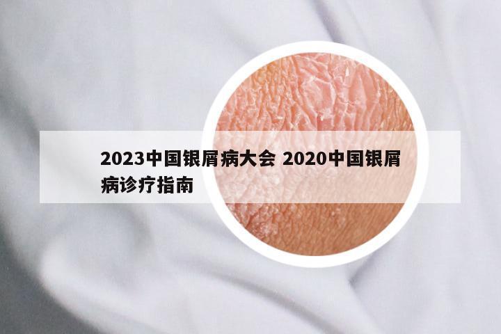 2023中国银屑病大会 2020中国银屑病诊疗指南