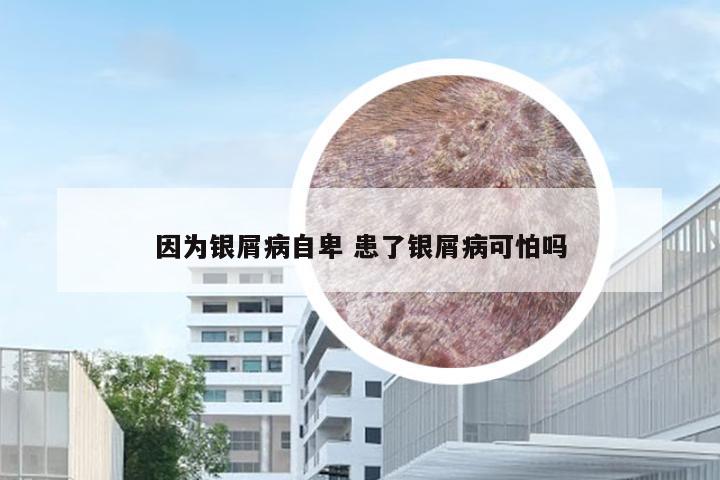 因为银屑病自卑 患了银屑病可怕吗