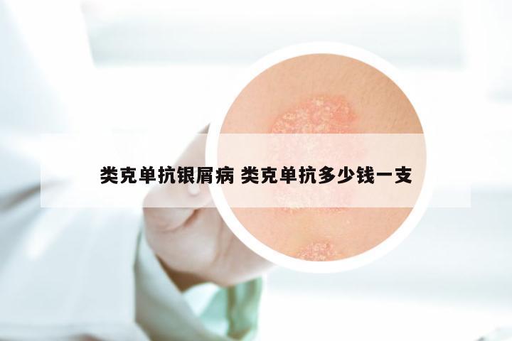 类克单抗银屑病 类克单抗多少钱一支