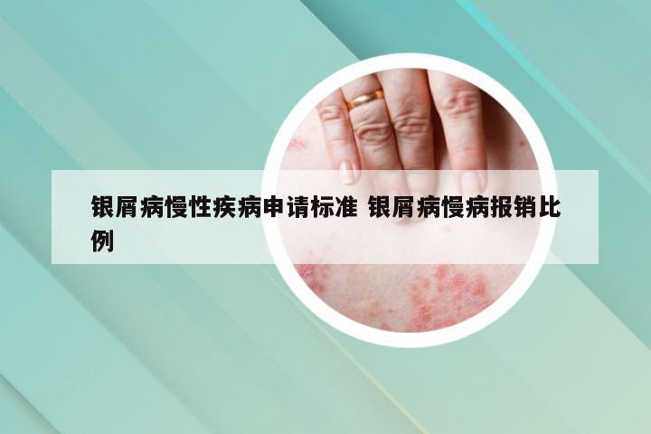 银屑病慢性疾病申请标准 银屑病慢病报销比例