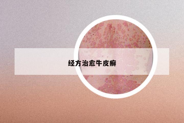 经方治愈牛皮癣